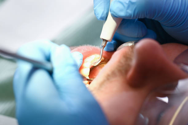 Best Chipped Tooth Repair Near Me  in Florence, AL