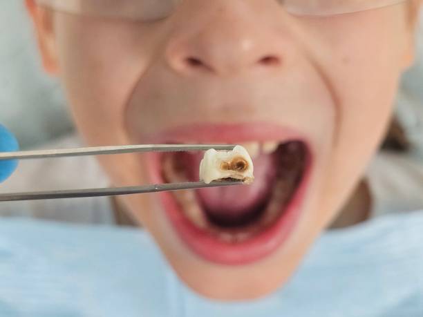 Best Tooth Pain Emergency Relief  in Florence, AL